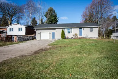 Detached in Oro-Medonte