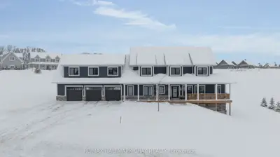 Detached in Oro-Medonte