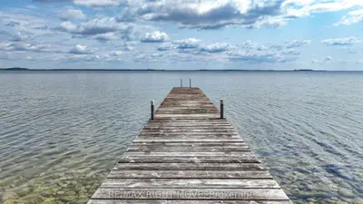 Detached in Oro-Medonte