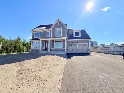Detached in Oro-Medonte